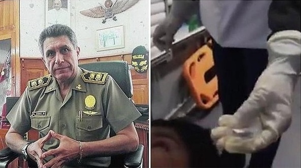 Arequipa: General de la PNP desmiente que herido por protesta en Matarani sea producto de una bala
