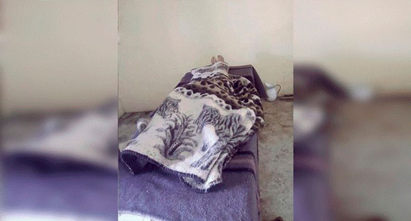 Puno: adolescente muere por ingerir carne de cerdo con triquina 