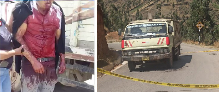 Familiares de chofer con bala alojada en cráneo piden que sea referido a Lima 