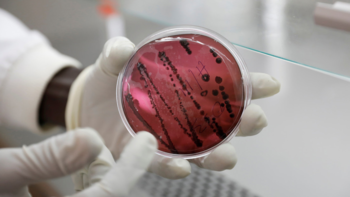 Un nuevo virus letal similar al Ã‰bola y que se contagia de persona a persona prende las alertas en Bolivia