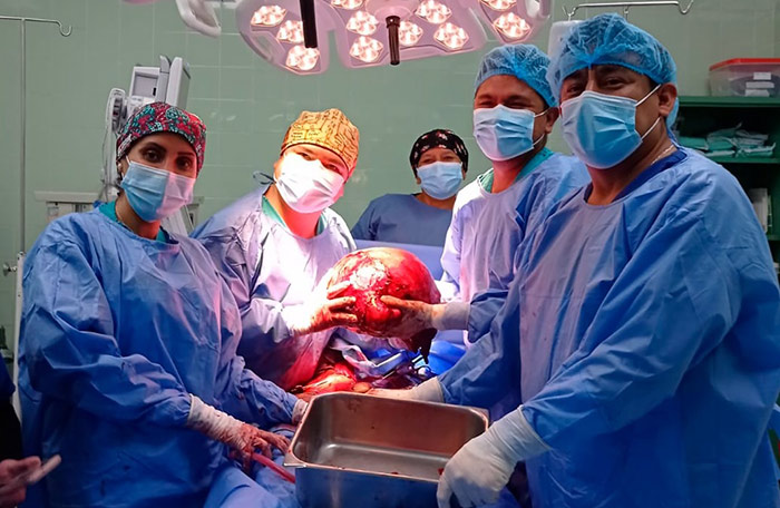 Médicos del Hospital Subregional de Andahuaylas extirpan mioma de más de 6 kilos a mujer