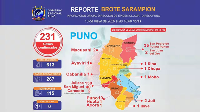 Puno: reportan 231 casos confirmados de sarampión