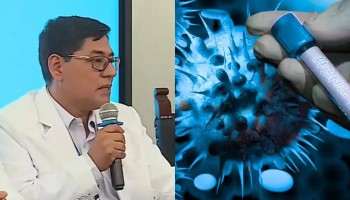 Minsa confirma los dos primeros casos de la variante A H3N2 de influenza en menores de edad en Perú