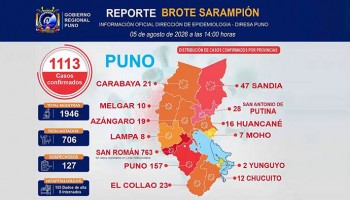 Puno: región supera 1,113 casos de sarampión y San Román concentra la mayoría