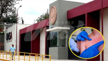 Arequipa: UNSA suspende clases presenciales en tres facultades por casos de sarampión