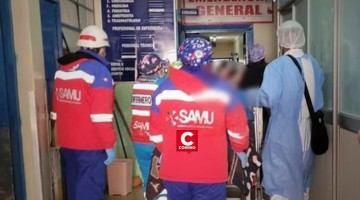 Puno: niña de 11 años fue hospitalizada tras quemaduras presuntamente causadas por su padrastro