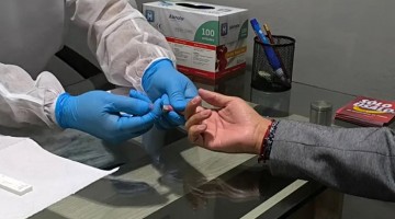 Cusco: Geresa reporta 193 nuevos casos de VIH y alerta contagio en población joven masculina