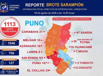 Puno: región supera 1,113 casos de sarampión y San Román concentra la mayoría
