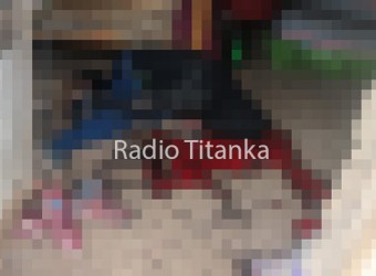 Mujer salvajemente agredida y que habría matado a pareja en defensa propia será referida a hospital de mayor complejidad