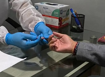 Cusco: Geresa reporta 193 nuevos casos de VIH y alerta contagio en población joven masculina