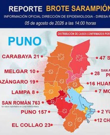 Puno: región supera 1,113 casos de sarampión y San Román concentra la mayoría
