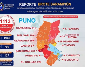Puno: región supera 1,113 casos de sarampión y San Román concentra la mayoría