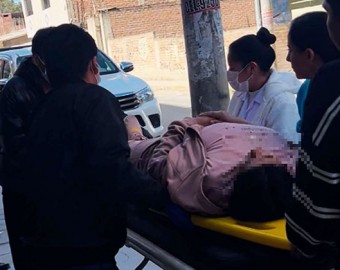 Talavera: pobladora sufre serias lesiones tras ser impactada por roca en obra vial de comunidad Otas Bellavista