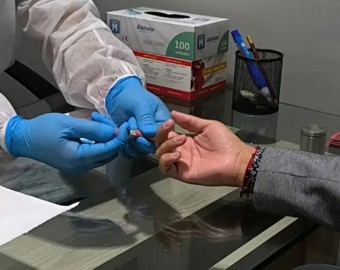 Cusco: Geresa reporta 193 nuevos casos de VIH y alerta contagio en población joven masculina